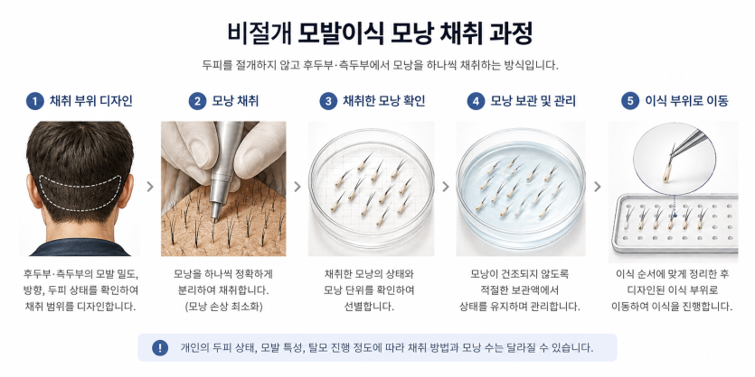 비절개모발이식 진행 과정