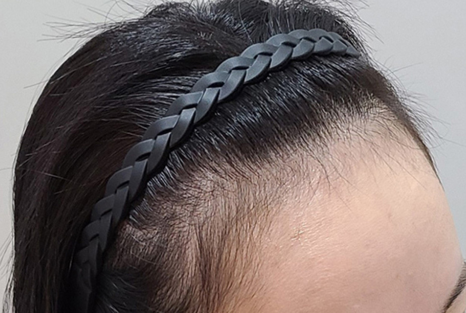 2400모 이식 전