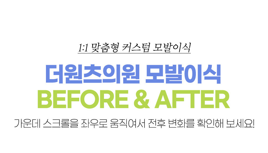 더원츠의원 모발이식 전후사진